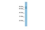 MTRR Antibody in Western Blot (WB)