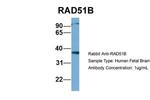 RAD51B Antibody in Western Blot (WB)