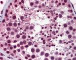 NASP Antibody in Immunohistochemistry (IHC)