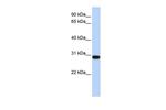 Bisphosphoglycerate mutase Antibody in Western Blot (WB)