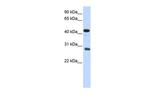 CDCA5 Antibody in Western Blot (WB)