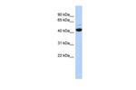 V-ATPase C1 Antibody in Western Blot (WB)