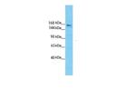 SLIT3 Antibody in Western Blot (WB)