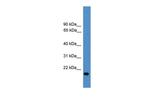 VEGFB Antibody in Western Blot (WB)