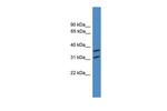 OTUD6A Antibody in Western Blot (WB)