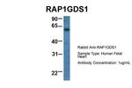 RAP1GDS1 Antibody in Western Blot (WB)