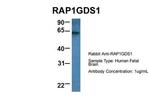 RAP1GDS1 Antibody in Western Blot (WB)