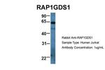 RAP1GDS1 Antibody in Western Blot (WB)