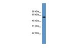 RAP1GDS1 Antibody in Western Blot (WB)