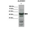 ALDH3A1 Antibody in Western Blot (WB)