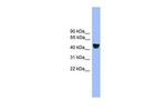 ALDH3A1 Antibody in Western Blot (WB)