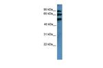 BBS2 Antibody in Western Blot (WB)