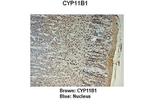 CYP11B1 Antibody in Immunohistochemistry (IHC)