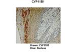 CYP11B1 Antibody in Immunohistochemistry (IHC)