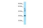 ATCAY Antibody in Western Blot (WB)