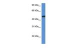 HEXA Antibody in Western Blot (WB)