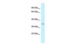 PDLIM7 Antibody in Western Blot (WB)