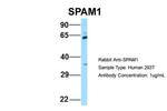 SPAM1 Antibody in Western Blot (WB)