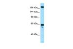 WNK2 Antibody in Western Blot (WB)