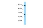 HGSNAT Antibody in Western Blot (WB)