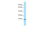 MRPL12 Antibody in Western Blot (WB)