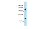 DGKD Antibody in Western Blot (WB)