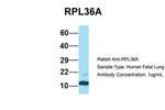 RPL36AL Antibody in Western Blot (WB)