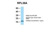 RPL36AL Antibody in Western Blot (WB)