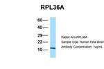 RPL36AL Antibody in Western Blot (WB)