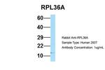 RPL36AL Antibody in Western Blot (WB)