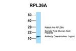 RPL36AL Antibody in Western Blot (WB)