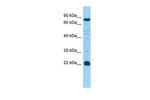 MED22 Antibody in Western Blot (WB)