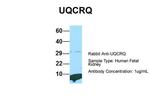 UQCRQ Antibody in Western Blot (WB)