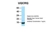 UQCRQ Antibody in Western Blot (WB)