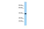 TICAM2 Antibody in Western Blot (WB)