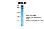 DHX40 Antibody in Western Blot (WB)