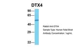 DTX4 Antibody in Western Blot (WB)