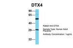 DTX4 Antibody in Western Blot (WB)