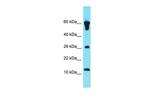 GCSAML Antibody in Western Blot (WB)