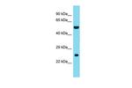 DNAAF3 Antibody in Western Blot (WB)