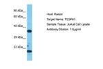 TESPA1 Antibody in Western Blot (WB)