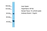 SP100 Antibody in Western Blot (WB)