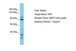 HIP1 Antibody in Western Blot (WB)