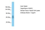 HIVEP1 Antibody in Western Blot (WB)