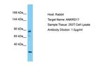 ANKRD17 Antibody in Western Blot (WB)