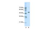 CHRNA9 Antibody in Western Blot (WB)