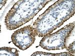 GABRP Antibody in Immunohistochemistry (Paraffin) (IHC (P))