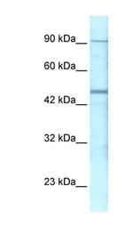 GABRP Antibody in Western Blot (WB)