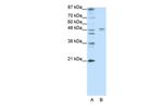 HTR1A Antibody in Western Blot (WB)