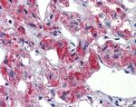 TAL1 Antibody in Immunohistochemistry (Paraffin) (IHC (P))